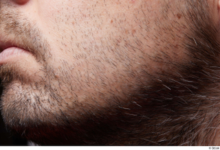 HD Face Skin Raul Conley chin face skin pores skin…